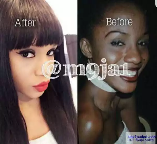 Photos: Maheeda Shares Before And After Bleaching Photos Of Herself